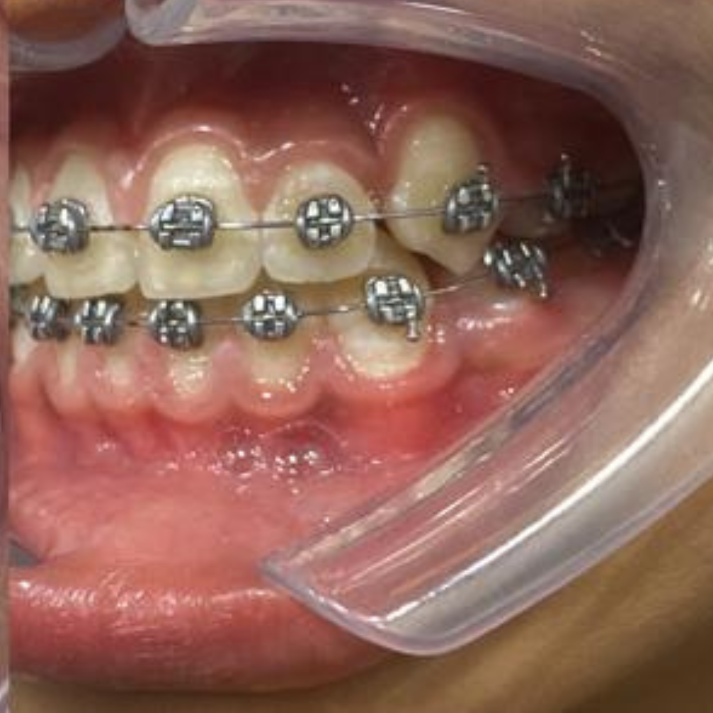عيادة سمايل لزراعة الاسنان تقويم اسنان